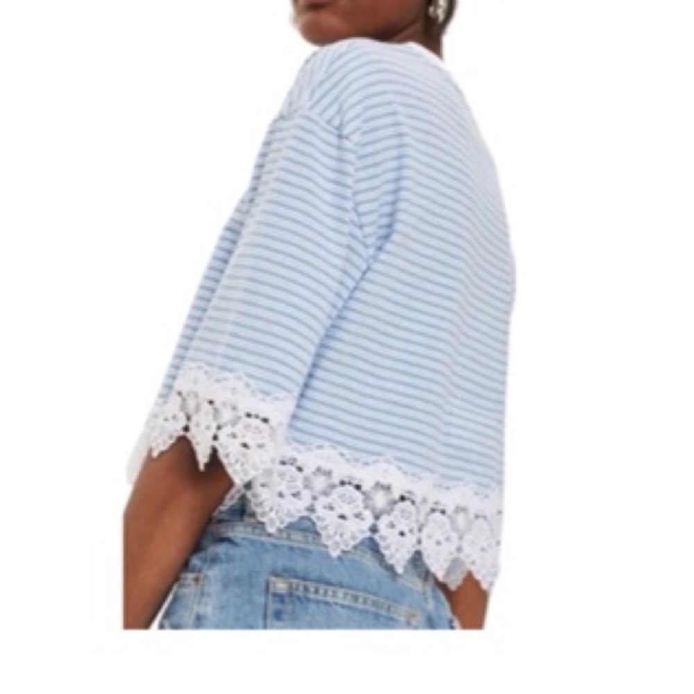 Topshop | Striped Lace Trim Cropped Top *NWT* - Picture 2 of 8